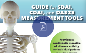 Rheumatoid-Arthritis-2
